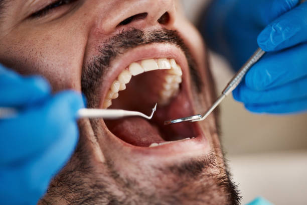 Best Dentist for Tooth Abscess  in Mabscott, WV